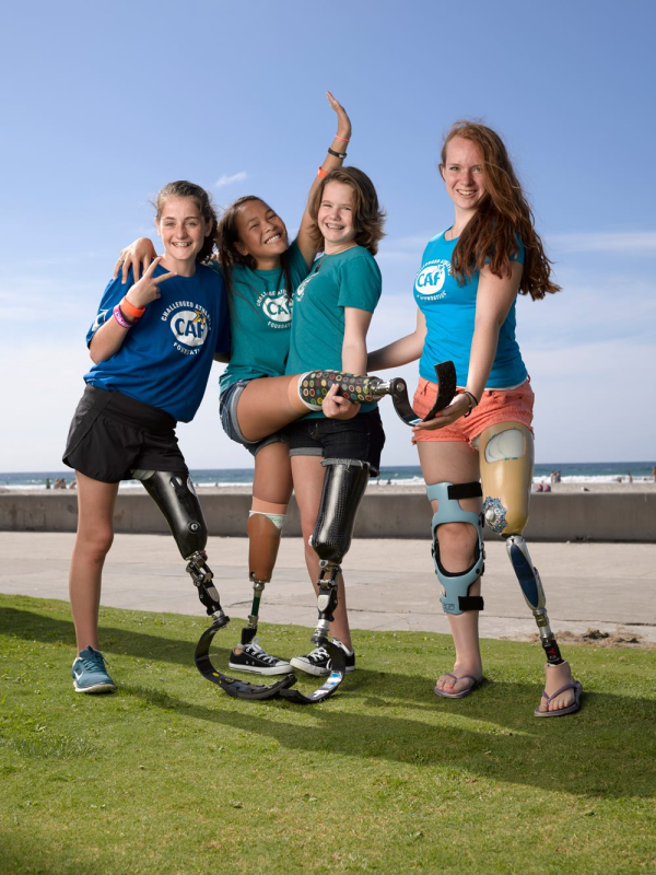 Four young athletes with limb differences smile and pose playfully together on the grass near the ocean, showing their prosthetic legs.